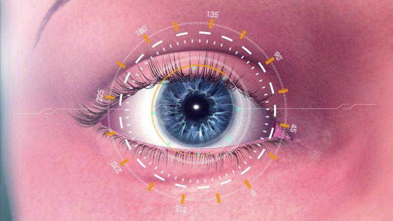 Omega Ophthalmics’ First Public Implantation of Its Omega Gemini Refractive Capsule