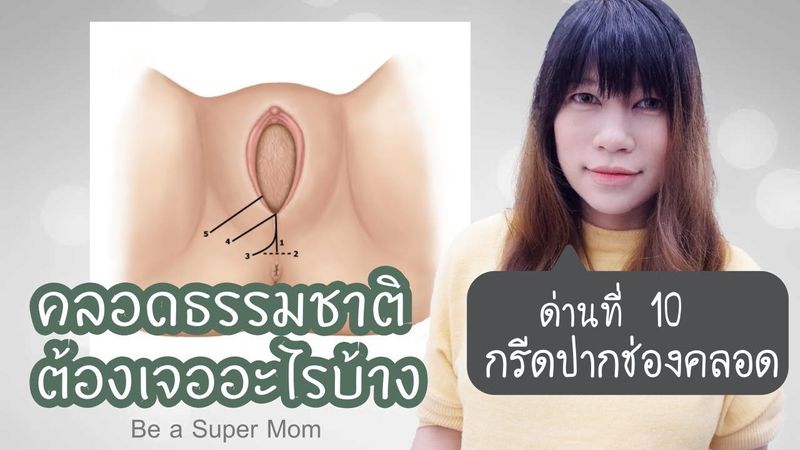 คลอดลูกต้องเจออะไรบ้าง ด่านที่ 10 กรีดปากช่องคลอด