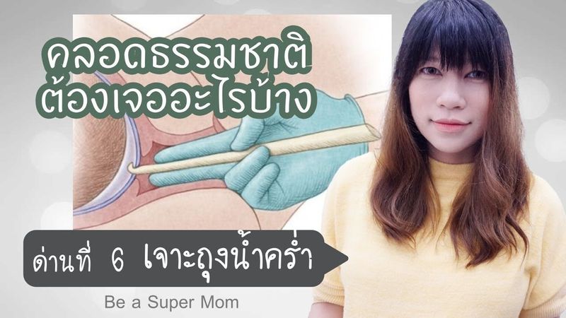 คลอดลูกต้องเจออะไรบ้าง ด่านที่ 6 เจาะถุงน้ำคร่ำ