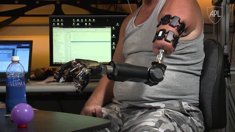 [ด.ดล Blog] Real Life Cyborg กับมนุษย์หุ่นยนต์คนแรกของโลก เทคโนโลยีใน ...