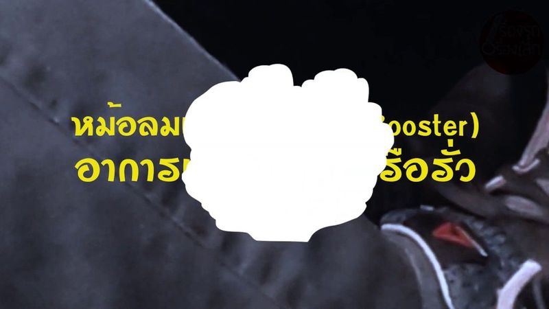 อาการหม้อลมเบรคเสีย-รั่ว Brake Booster