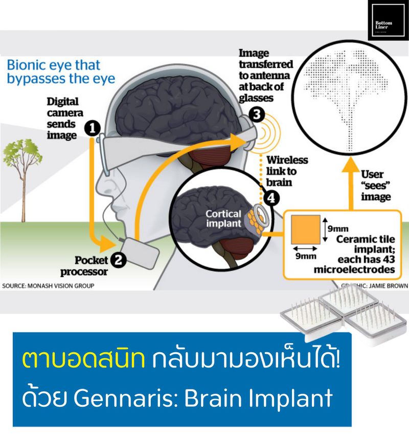 [สรุปหุ้น กองทุน ต่างประเทศ - BottomLiners] ตาบอดสนิท รักษาได้ ...