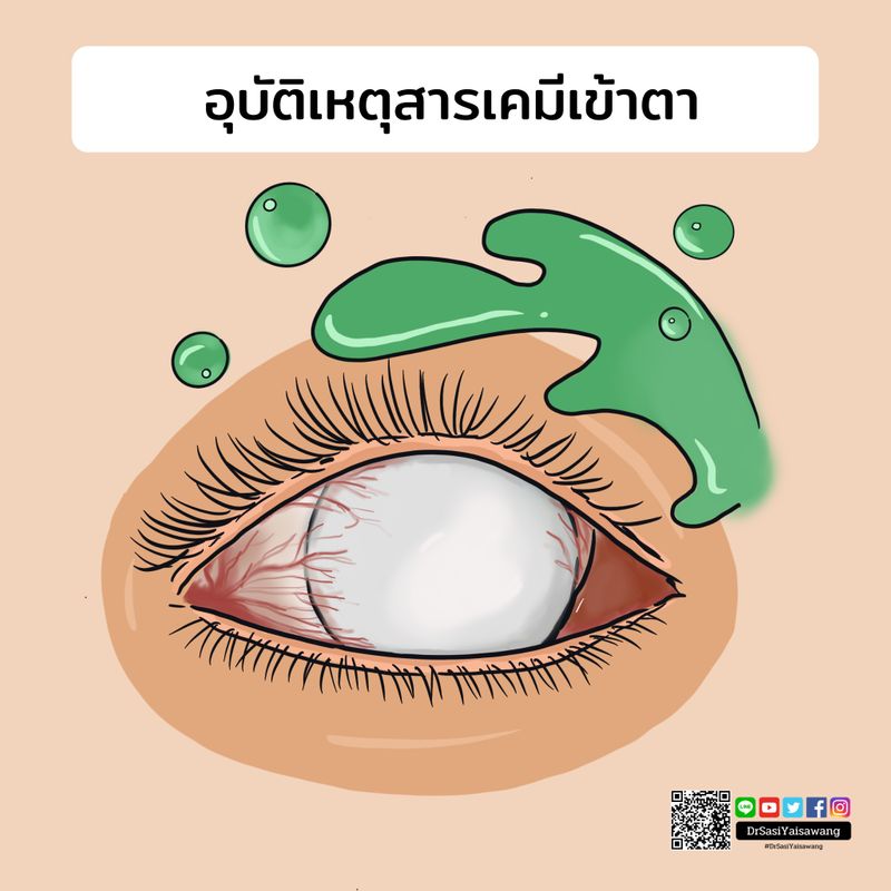 My Image 3
