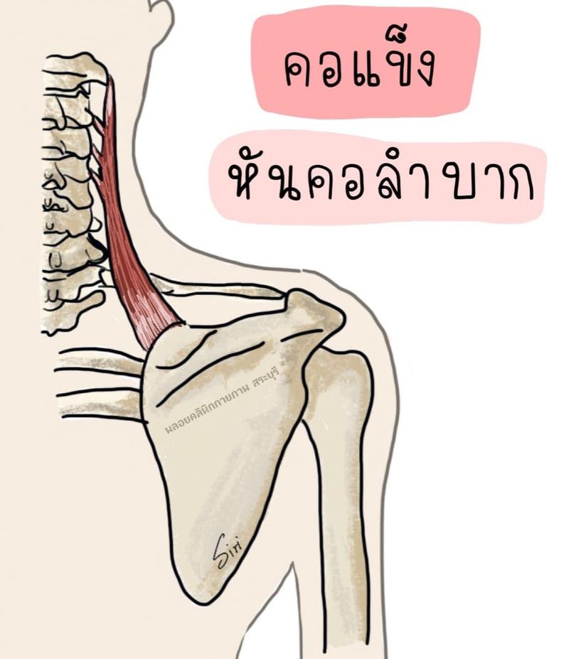 My Image 21