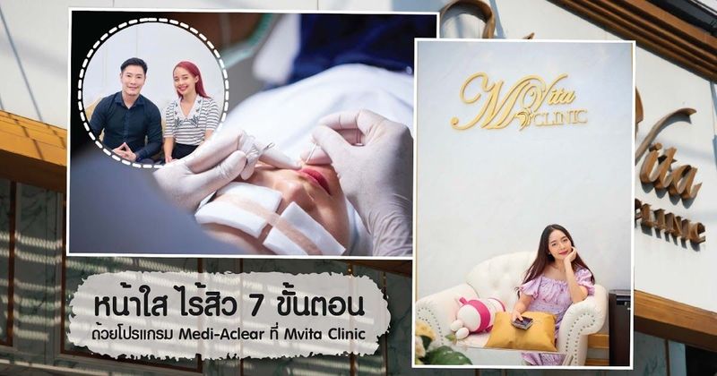 รีวิว : รักษาสิว หน้าใสใน 7 ขั้นตอน ด้วยโปรแกรม Medi-Aclear ที่ m vita clinic