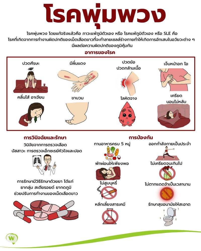 อันดับหนึ่ง 103+ ภาพพื้นหลัง sle ย่อมาจาก คมชัด