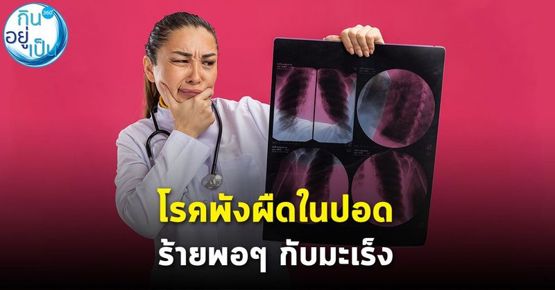 ไขข้อเข้าใจผิด เมื่อโรคพังผืดในปอด ร้ายพอๆ กับมะเร็ง