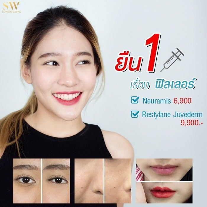 โปรโมชั่นฟิลเลอร์ เติมเต็มความสวยด้วยฟิลเลอร์ของแท้ - SoWon Clinic