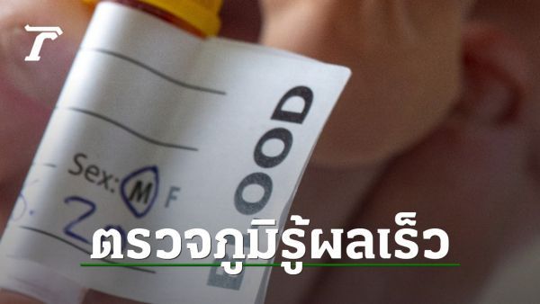 นักวิทย์สิงคโปร์พัฒนาชุดตรวจเลือด วัดภูมิคุ้มกันโควิดได้ใน 10 นาที