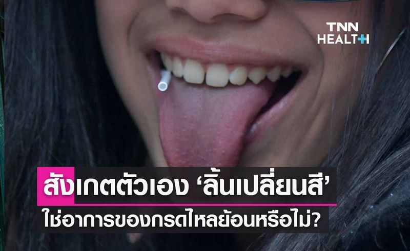 สังเกต ‘ลิ้นเปลี่ยนสี’ ใช่อาการแรกเริ่มของกรดไหลย้อนหรือไม่?