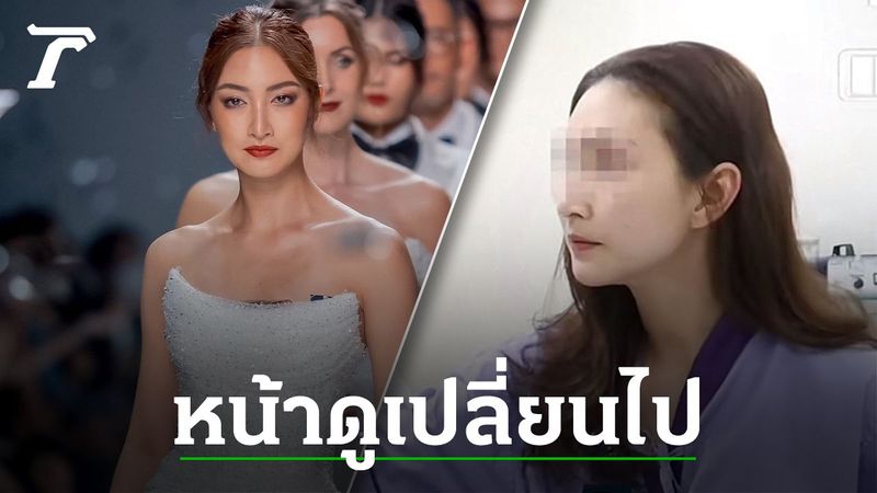 เปิดภาพล่าสุด แพนเค้ก เขมนิจ หลังตัดสินใจศัลยกรรมครั้งแรกในชีวิต หน้าเปลี่ยนไปมาก