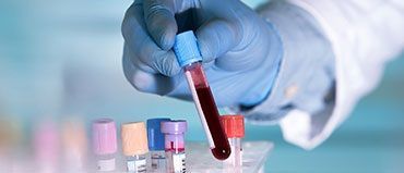 Taste Modulators Market Size, Share, Trends - 2027