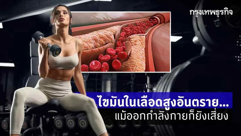 ″ไขมันในเลือดสูง” ไม่มีอาการ เสี่ยงเสียชีวิตฉับพลันแม้ออกกำลังกาย