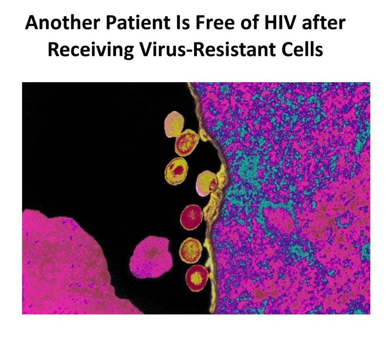 [Wichai Purisa ] Another Patient Is Free of HIV after Receiving Virus ...