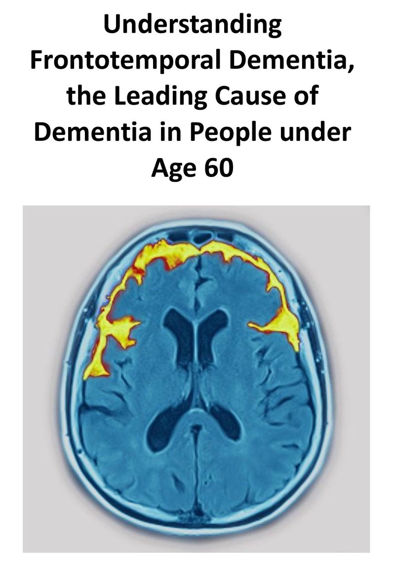 [Wichai Purisa ] Understanding Frontotemporal Dementia, the Leading ...