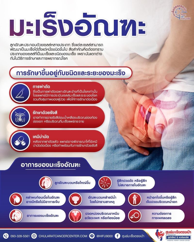 [ศูนย์มะเร็งตรงเป้า รพ.จุฬารัตน์9แอร์พอร์ต] มะเร็งอัณฑะ Testicular