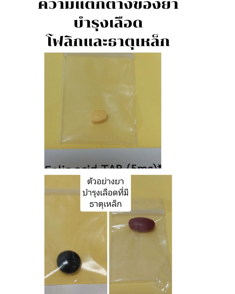 [เรื่องเล่าจากห้องยา] ยาบำรุงเลือดเม็ดสีเหลือง โฟลิก(Folic acid) กับ ยา ...