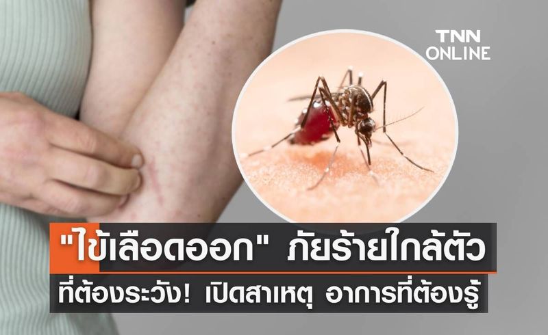 ″ไข้เลือดออก” ภัยร้ายใกล้ตัวที่ต้องระวัง! เปิดสาเหตุ อาการ และแนวทางการป้องกัน