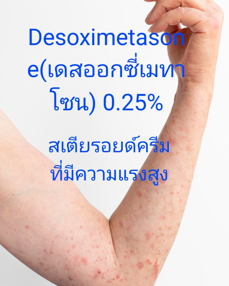 [เรื่องเล่าจากห้องยา] เดสออกซี่เมทาโซน 0.25% #Desoximethasone 0.25% ยา ...