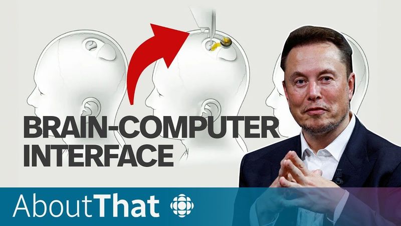 Neuralink brain chip’s first human patient. How does it work? | About That