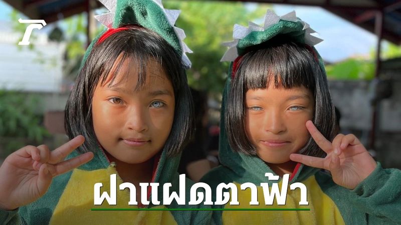 โซเชียลชื่นชมความน่ารัก ”น้องกิ๊ฟ น้องแก้ม” เด็กหญิงฝาแฝดตาสีฟ้า