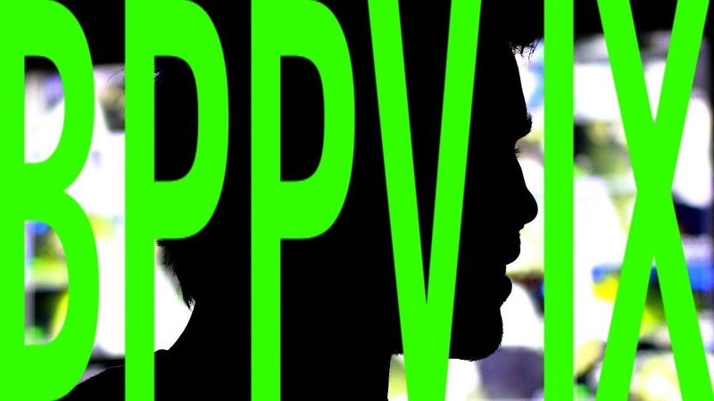 BPPV IX