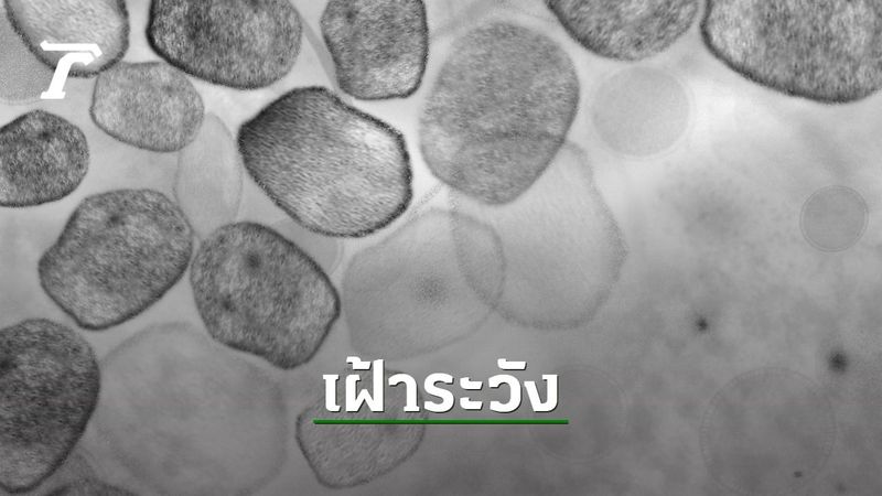 ญี่ปุ่นเฝ้าระวัง ”โรคหัด” ระบาดหนัก ติดเชื้อแล้ว 78 ราย เกินยอดทั้งปี 2024