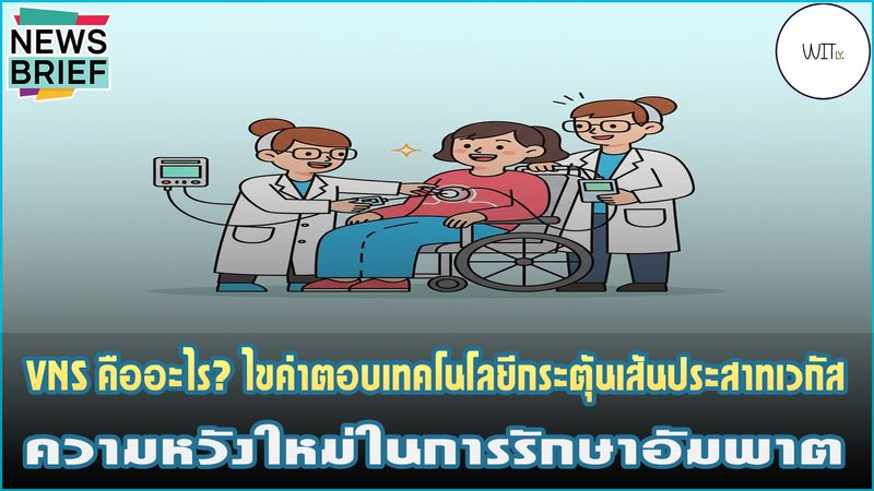 [Witly. - เปิดโลกวิทย์แบบเบา ๆ] 🧠 VNS คืออะไร? ไขคำตอบเทคโนโลยีกระตุ้น ...