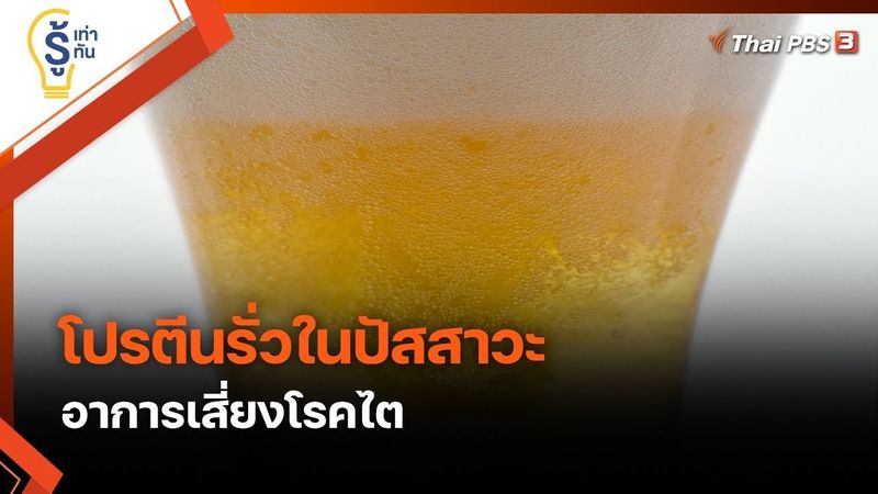 ″โปรตีนรั่วในปัสสาวะ” อาการเสี่ยงโรคไต : รู้เท่ารู้ทัน