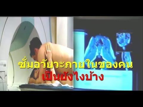 มาดูอัลตร้าซาวด์ตอนมีเซ็กส์กัน ว่าขณะซั่มอวัยวะภายในของคนเป็นยังไงบ้าง