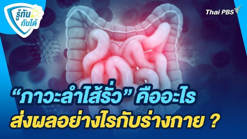″ภาวะลำไส้รั่ว” คืออะไร ส่งผลอย่างไรกับร่างกาย ? | รู้ทันกันได้ | วันใหม่วาไรตี้