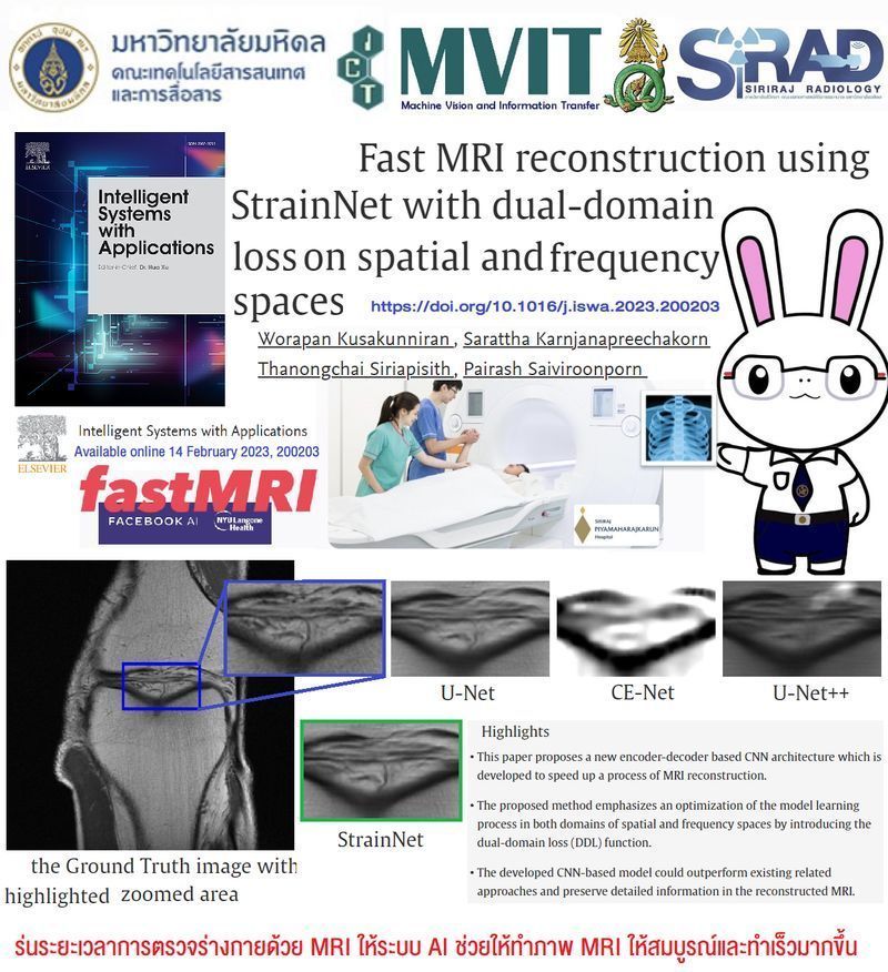 [MVIT Research LAB : Mahidol University] ทำ MRI Scan เร็วขึ้น 4-8เท่า จากเดิม ด้วย AI
ทำMRI Scan เร็วขึ้น 4-8เท่า จากอุปกรณ์เดิม ได้อย่างไร มาดูสรุปในบทความ ”งานวิจัย AI ด้านการแพทย์🩻”
ร่นระยะเวลาการตรวจร่างกายด้วย MRI ให้ระบบ AI ช่วยให้ทำภ