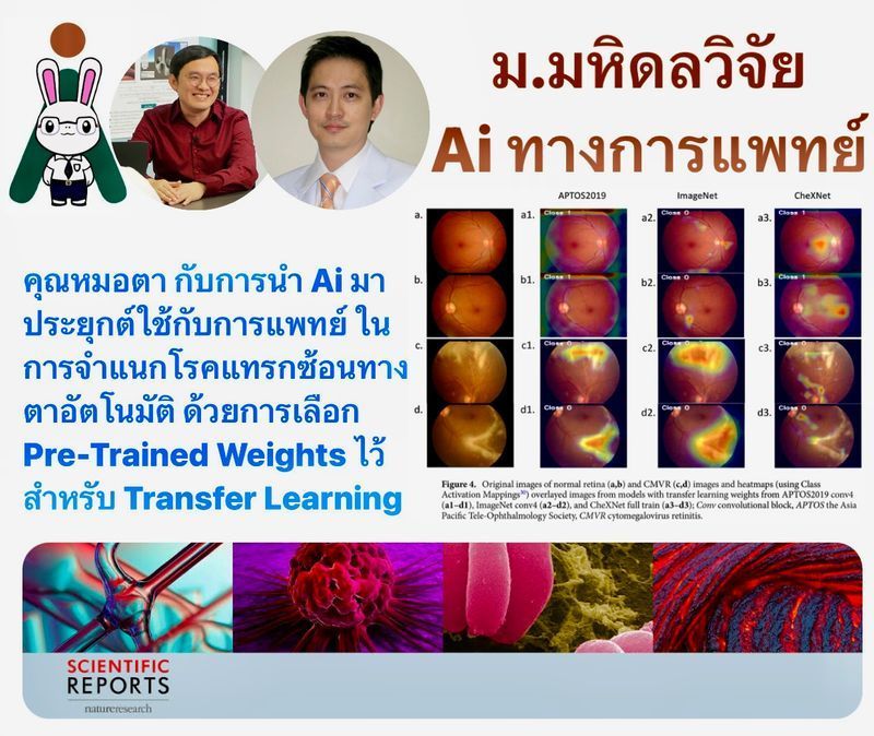 [MVIT Research LAB : Mahidol University] 🤖 มาพบกับรายละเอียดของผลงานตีพิมพ์ การจำแนกโรคแทรกซ้อนทางตาอัตโนมัติ 👁️
มาพบกับรายละเอียดของผลงานตีพิมพ์ การจำแนกโรคแทรกซ้อนทางตาอัตโนมัติ ด้วยการเลือก Pre-Trained Weights ไว้สำหรับ Transfer Learnin