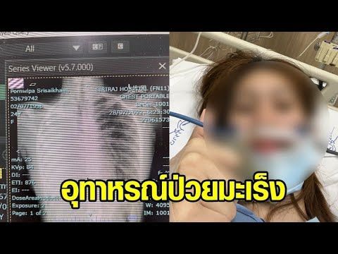 สาววัย 24 แชร์อุทาหรณ์ชีวิต ป่วยมะเร็งปอดระยะสุดท้าย คาดสาเหตุอยู่ใกล้คนสูบบุหรี่