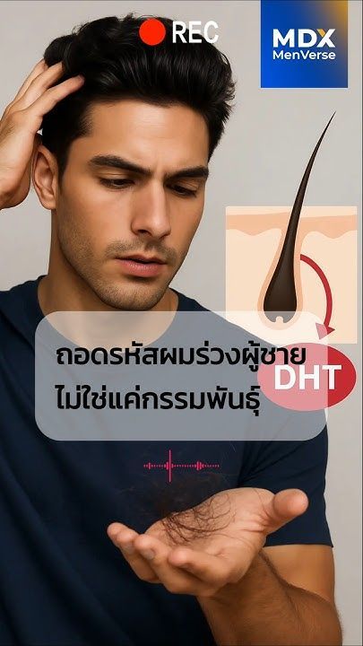 EP51: ถอดรหัสผมร่วงผู้ชาย ไม่ใช่แค่กรรมพันธุ์ แต่ไลฟ์สไตล์และความเครียดคือตัวการสำคัญ #mdx #men
