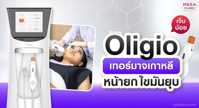 Oligio คืออะไร? ราคาเท่าไหร่ เจ็บไหม เหมาะกับใคร? | MEGA CLINIC