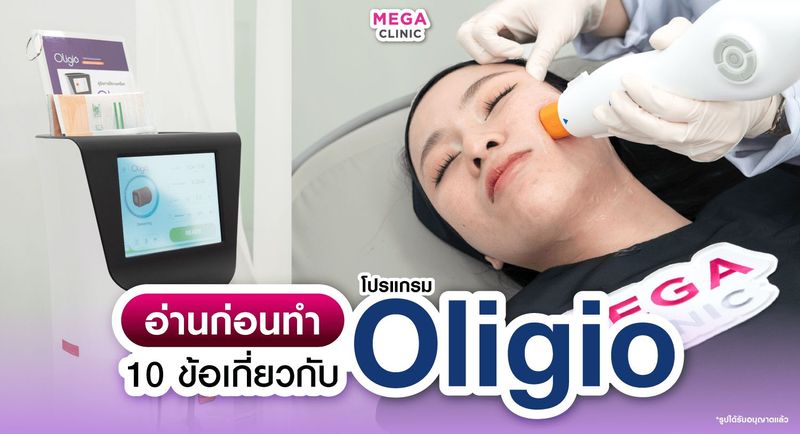 Oligio เทอร์มาจเกาหลี เวอร์ชั่นเจ็บน้อย รวม 10 ข้อควรรู้ก่อนทำ
