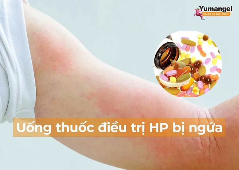 Uống thuốc điều trị HP bị ngứa có nguy hiểm không? - Yumangel