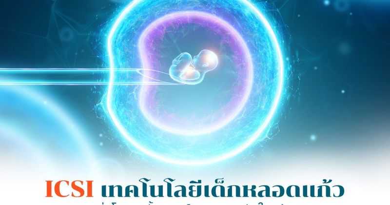 ICSI อิ๊กซี่ การทำเด็กหลอดแก้ววิธีใหม่ รักษาภาวะมีบุตรยาก