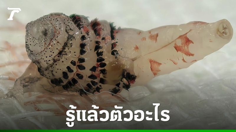 เพจดังเฉลยแล้ว “ตัวอะไร” อยู่ใต้ผิวหนังคนไข้ชาวต่างชาติ แนะเจอให้รีบไปหาหมอ