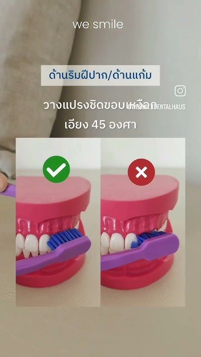 วิธีแปรงฟันอย่างถูกวิธี