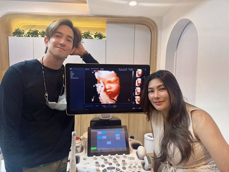 ส่งใจให้ “นุ่น รมิดา – หลุยส์ สก๊อต” หลังแจ้งข่าวสูญเสียลูก เตรียมตั้งโต๊ะแถลงความคืบหน้าพร้อมทีมแพทย์