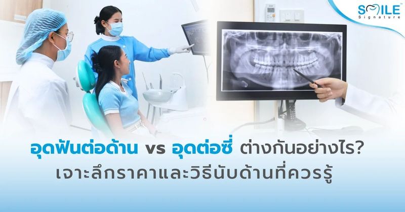 อุดฟันต่อด้าน vs ต่อซี่ ต่างกันอย่างไร? เจาะลึกราคาและวิธีนับด้านที่ควรรู้ | คลินิกทันตกรรมสไมล์ ซิกเนเจอร์
