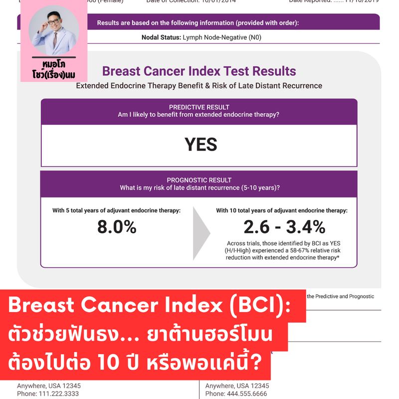 [หมอโภโชว์(เรื่อง)นม] Breast Cancer Index (BCI): ตัวช่วยฟันธง... ยาต้าน ...