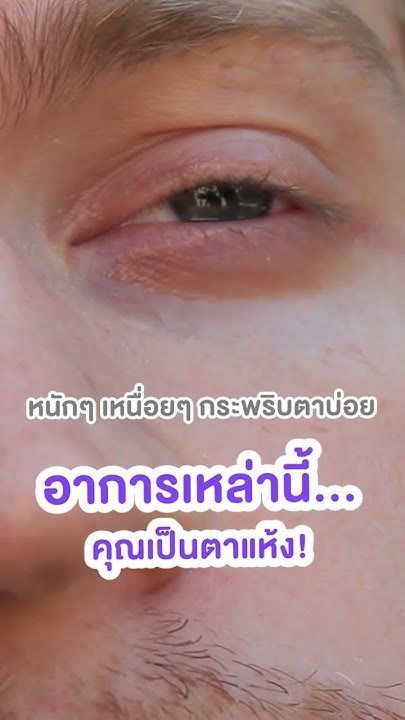 หนักตาอยากจะหลับ 🥱 เพราะง่วงหรือตาแห้ง โดย พญ.ตุลยา ตั้งศิริพัฒน์