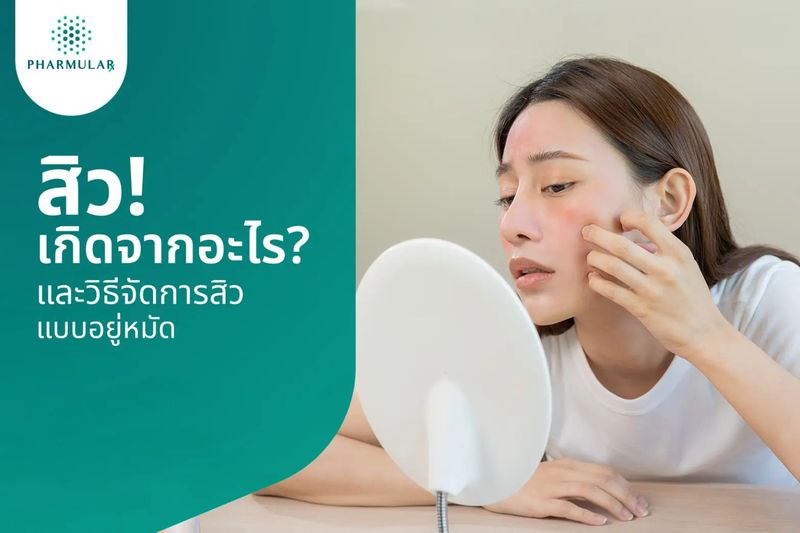 สิวคืออะไร พร้อมสาเหตุ หยุดวงจรเกิดสิว แชร์วิธีรักษาสิวหายไว