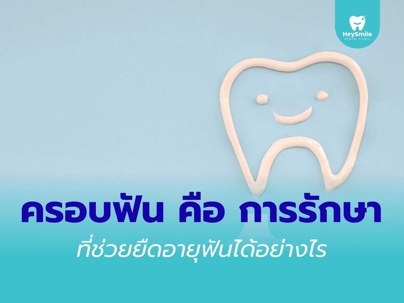 ครอบฟัน คือ การรักษาที่ช่วยยืดอายุฟันได้อย่างไร - HeySmile Dental Clinic