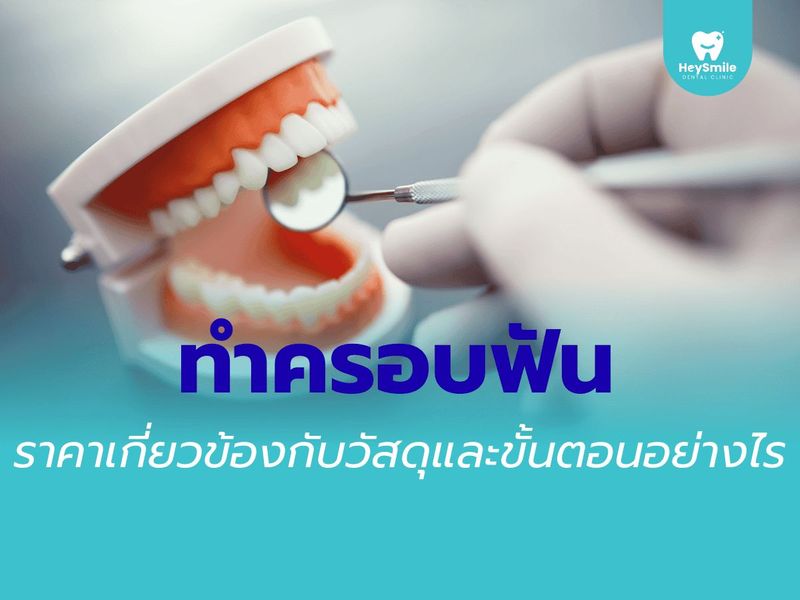 ทำ ครอบฟัน ราคา เกี่ยวข้องกับวัสดุและขั้นตอนอย่างไร - HeySmile Dental Clinic
