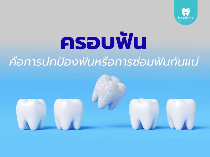 ครอบฟัน คือ การปกป้องฟันหรือการซ่อมฟันกันแน่ - HeySmile Dental Clinic