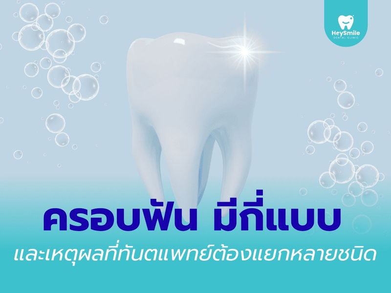 ครอบฟัน มีกี่แบบ และเหตุผลที่ทันตแพทย์ต้องแยกหลายชนิด - HeySmile Dental Clinic